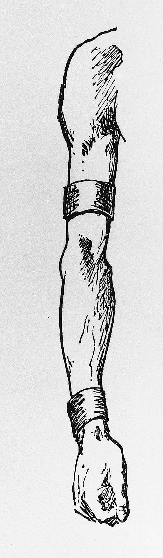 Arm and Hand